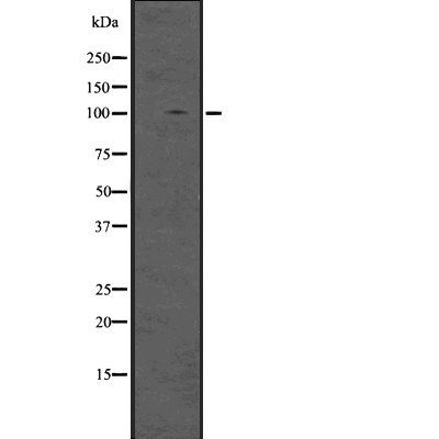DGCR8 Antibody - Western blot analysis of DGCR8 using HeLa whole cell lysates.