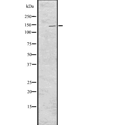 pan Cadherin Antibody - Western blot analysis of pan Cadherin using 293 whole cell lysates.