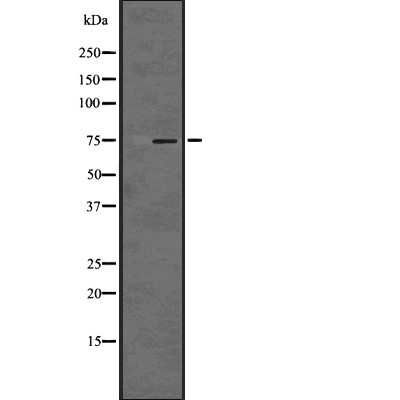 PKC alpha Antibody - Western blot analysis of PKC alpha using HT-29 whole cell lysates.