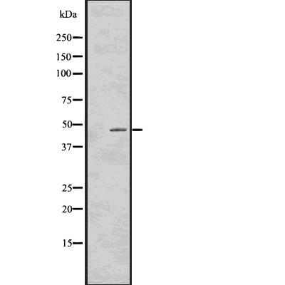 TDP43 Antibody - Western blot analysis of TDP43 using HT-29 whole cell lysates.
