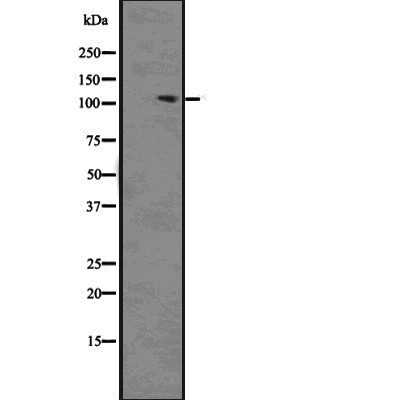 Phospho-ACK1 (Tyr857/Tyr858)[Tyr859/Tyr860] Antibody - Western blot analysis of extracts from HeLa cells, using Phospho-Ack1 (Tyr857/Tyr858) Antibody.