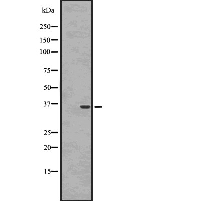 NKX6.3 Antibody - Western blot analysis NKX6.