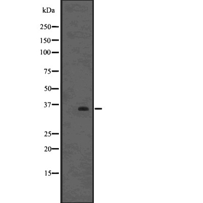TTF2 Antibody - Western blot analysis of TTF2 using 293 whole cell lysates.