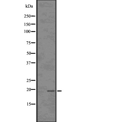 TP53I11 Antibody - Western blot analysis of TP53I11 using 293 whole cell lysates.