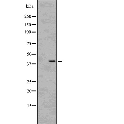 RANKL Antibody - Western blot analysis of TNFSF11 using COLO205 whole cell lysates.