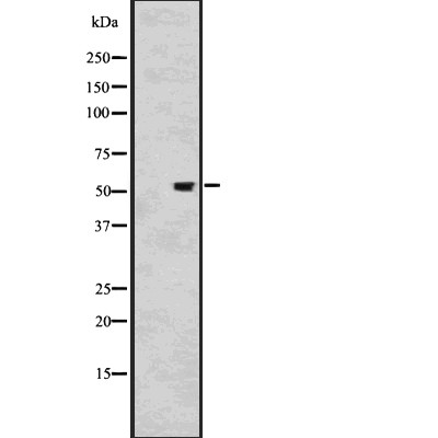 KLF11 Antibody - Western blot analysis of KLF11 using HT-29 whole cell lysates.