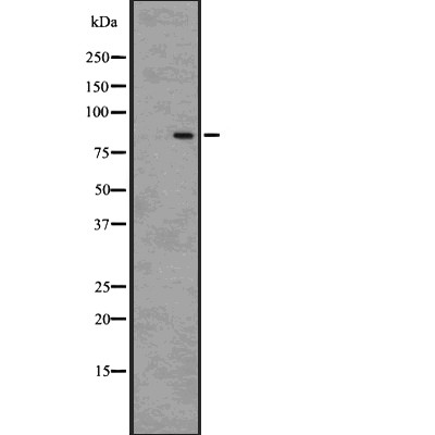 HGS Antibody - Western blot analysis of HGS using HT-29 whole cell lysates.
