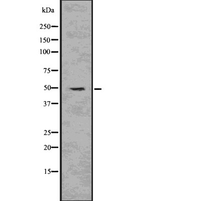PAX6 Antibody - Western blot analysis of Pax-6 using HepG2 whole  lysates.