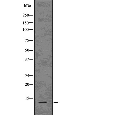 TXN Antibody - Western blot analysis of TXN using COLO205 whole  lysates.