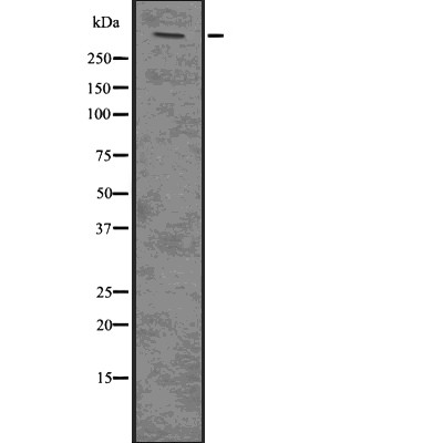 PLEC Antibody - Western blot analysis of PLEC using Jurkat whole  lysates.