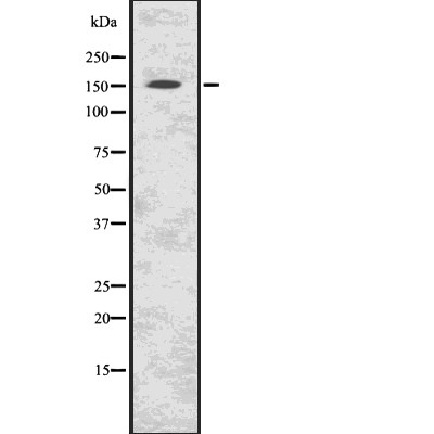 C11orf30 Antibody - Western blot analysis of C11orf30 using K562 whole  lysates.