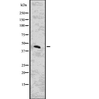 CYTH3 Antibody - Western blot analysis of CYTH3 using COLO205 whole  lysates.