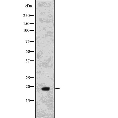 IL15 Antibody - Western blot analysis of IL15 using A549 whole  lysates.