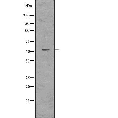 DNAJC3 Antibody - Western blot analysis of DNAJC3 using HuvEc whole  lysates.