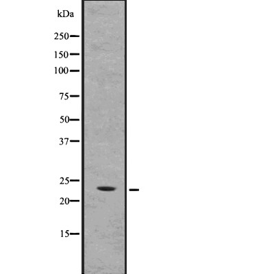 CRADD Antibody - Western blot analysis of CRADD using HepG2 whole  lysates.