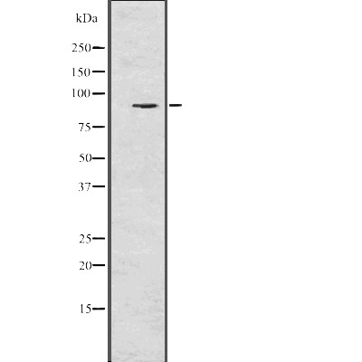 RSK1 p90 Antibody - Western blot analysis of RSK1 p90 using Jurkat whole  lysates.