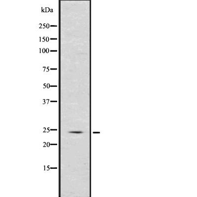 Phospholamban Antibody - Western blot analysis of Phospholamban using 293 whole  lysates.