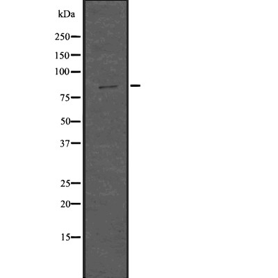 SMURF1 Antibody - Western blot analysis of Smurf1 using HuvEc whole  lysates.