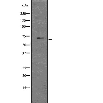 GLIS1 Antibody - Western blot analysis of GLIS1 using HT29 whole  lysates.