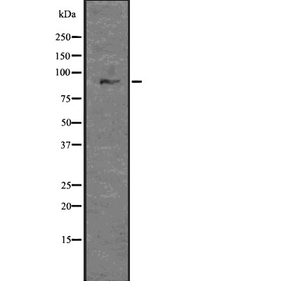 GLIS3 Antibody - Western blot analysis of GLIS3 using Jurkat whole  lysates.