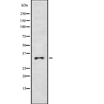 IGFBP2 Antibody - Western blot analysis of IGFBP2 using Jurkat whole  lysates.