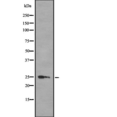 HMGB3 Antibody - Western blot analysis of HMGB3 using COLO205 whole  lysates.