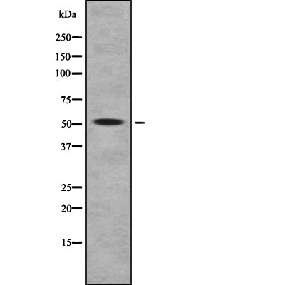 Vitamin D Binding protein Antibody - Western blot analysis of GC using HeLa whole  lysates.