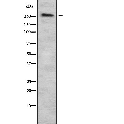 SPTAN1 Antibody - Western blot analysis of SPTAN1 using HuvEc whole  lysates.