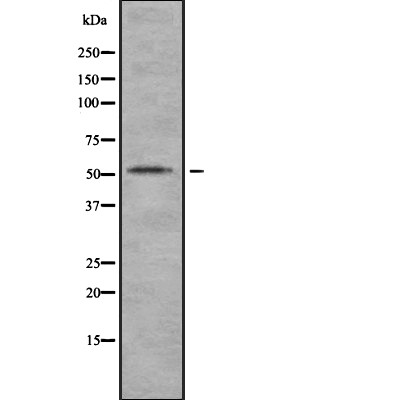 CaMKII alpha Antibody - Western blot analysis of CAMK2A using HT29 whole  lysates.