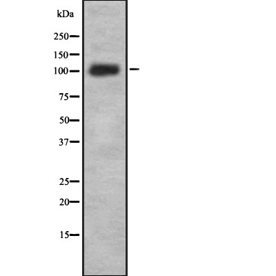PUM2 Antibody - Western blot analysis of PUM2 using Jurkat whole  lysates.