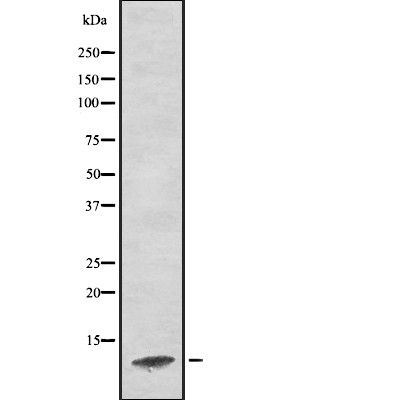 C17orf37 Antibody - Western blot analysis of C17orf37 using K562 whole  lysates.