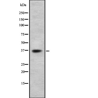 ICAD Antibody - Western blot analysis of DFFA using Jurkat whole  lysates.