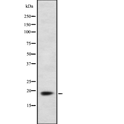 FDX1 Antibody - Western blot analysis of FDX1 using HepG2 whole  lysates.
