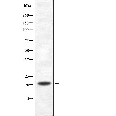 PDCD6 Antibody - Western blot analysis of PDCD6 using K562 whole  lysates.