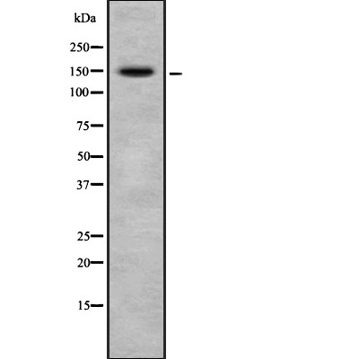 CRSP130 Antibody - Western blot analysis of CRSP130 using A549 whole cell lysates.