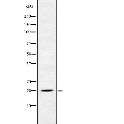 FGF-22 Antibody - Western blot analysis FGF-22 using Jurkat whole cell lysates.