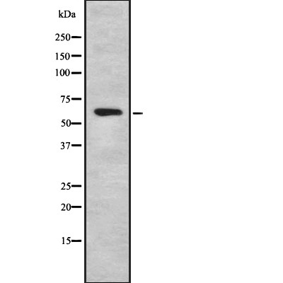 HABP2 Antibody - Western blot analysis of HABP2 using HeLa whole cell lysates.