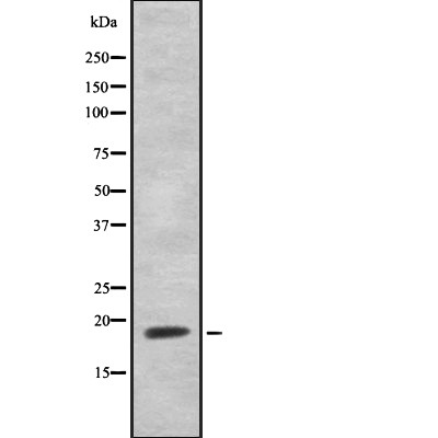 HEN1/2 Antibody - Western blot analysis of HEN1/2 using Jurkat whole cell lysates.
