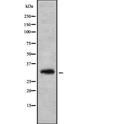 HoxD8 Antibody - Western blot analysis of HoxD8 using K562 whole cell lysates.