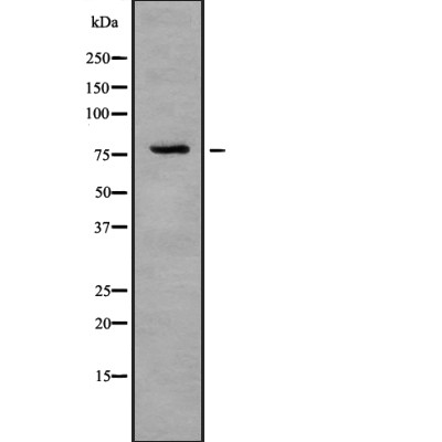 IL-1R9 Antibody - Western blot analysis IL-1R9 using COLO205 whole cell lysates.
