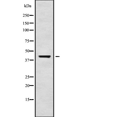 GIRK1/KIR3.1/KCNJ3 Antibody - Western blot analysis of KIR3.