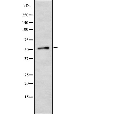MCT12 Antibody - Western blot analysis of MCT12 using K562 whole cell lysates.