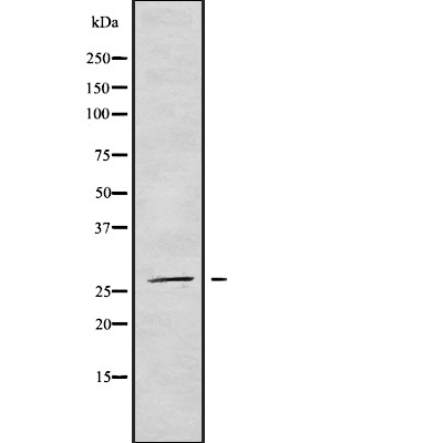 NRIP3 Antibody - Western blot analysis NRIP3 using COLO205 whole cell lysates.