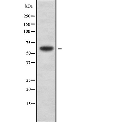 POTE-14/22 Antibody - Western blot analysis of POTE-14/22 using MCF7 whole cell lysates.