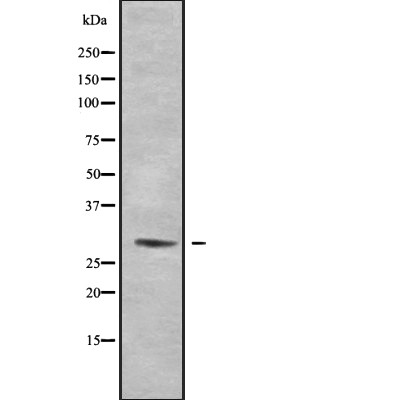 Rab 34 Antibody - Western blot analysis of Rab 34 using HepG2 whole cell lysates.