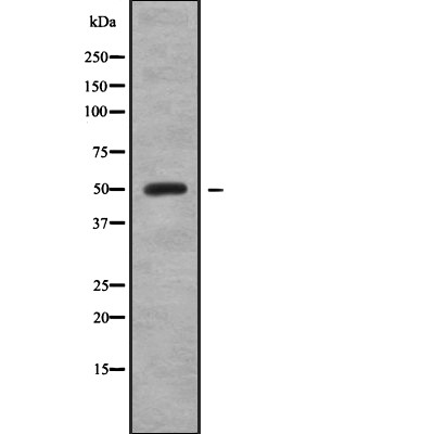 RBM34 Antibody - Western blot analysis of RBM34 using HepG2 whole cell lysates.