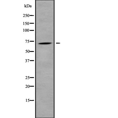 RHOBTB3 Antibody - Western blot analysis of RHOBTB3 using K562 whole cell lysates.
