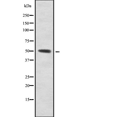 SUHW1 Antibody - Western blot analysis SUHW1 using HeLa whole cell lysates.