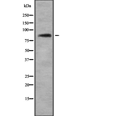 TLE4 Antibody - Western blot analysis of TLE4 using Jurkat whole cell lysates.