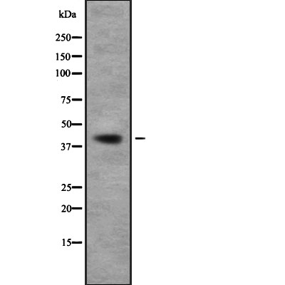 TOB1 Antibody - Western blot analysis of TOB1 using HT29 whole cell lysates.